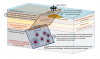 GEoREST - Castor offshore platform and Amposta Fall